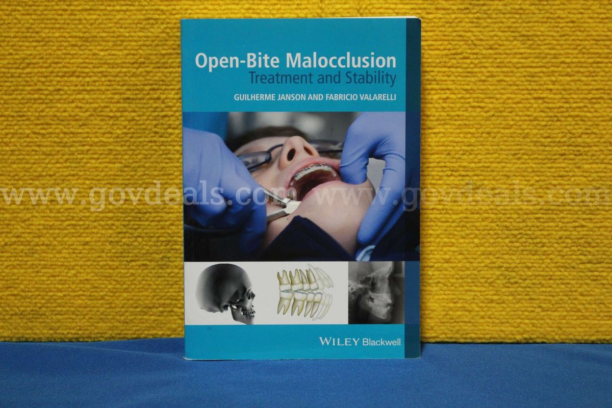 Open-Bite Malocclusion: Treatment and Stability Book