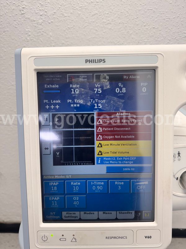 Philips V60 Ventilator